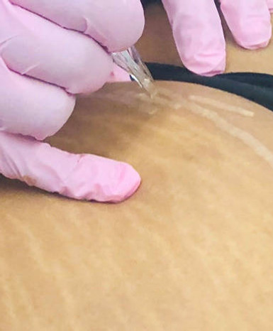 Curso de Camuflagem de Estrias é bom?