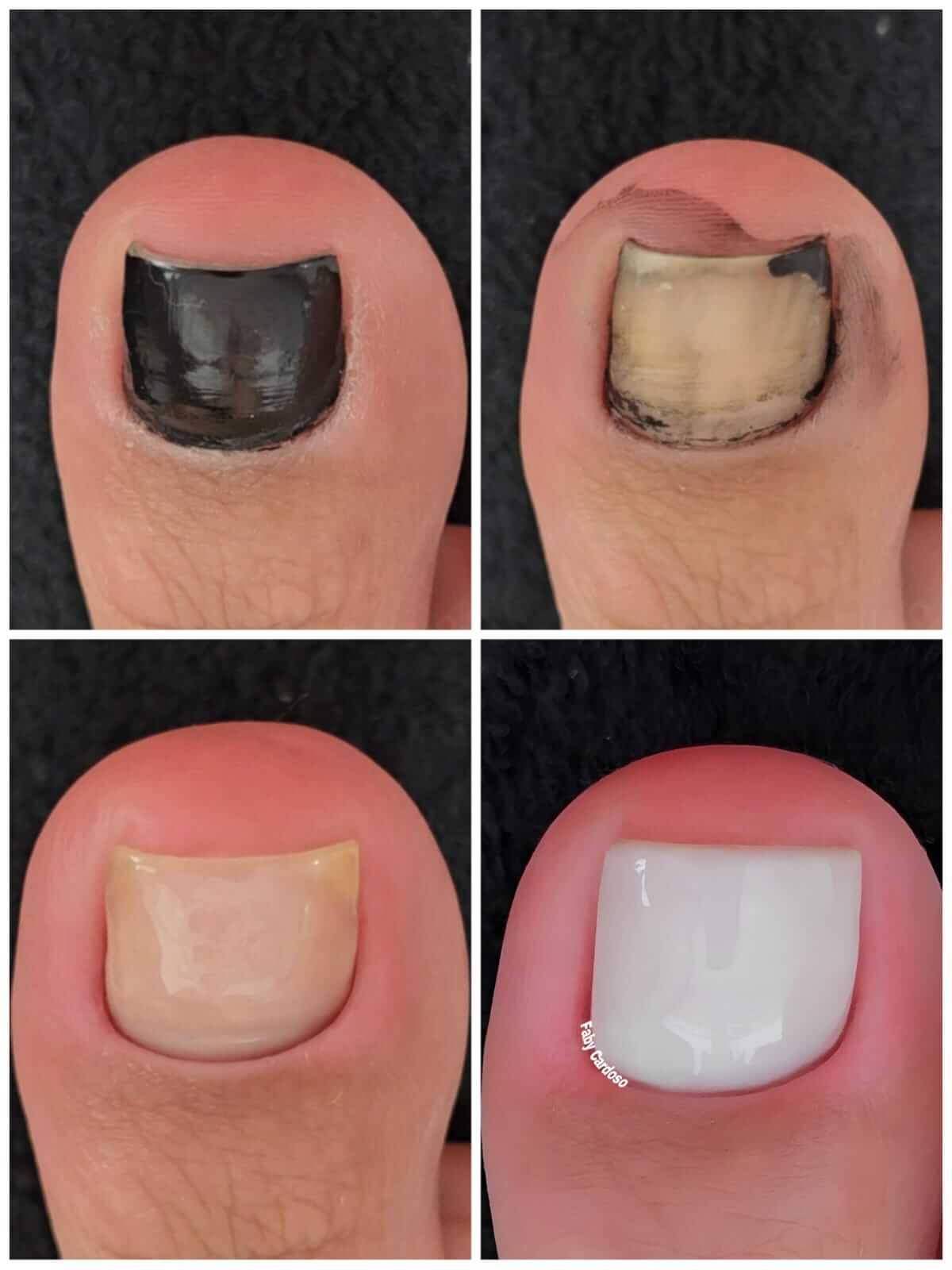 Curso Pedicure Sem Segredos vale a pena comprar?