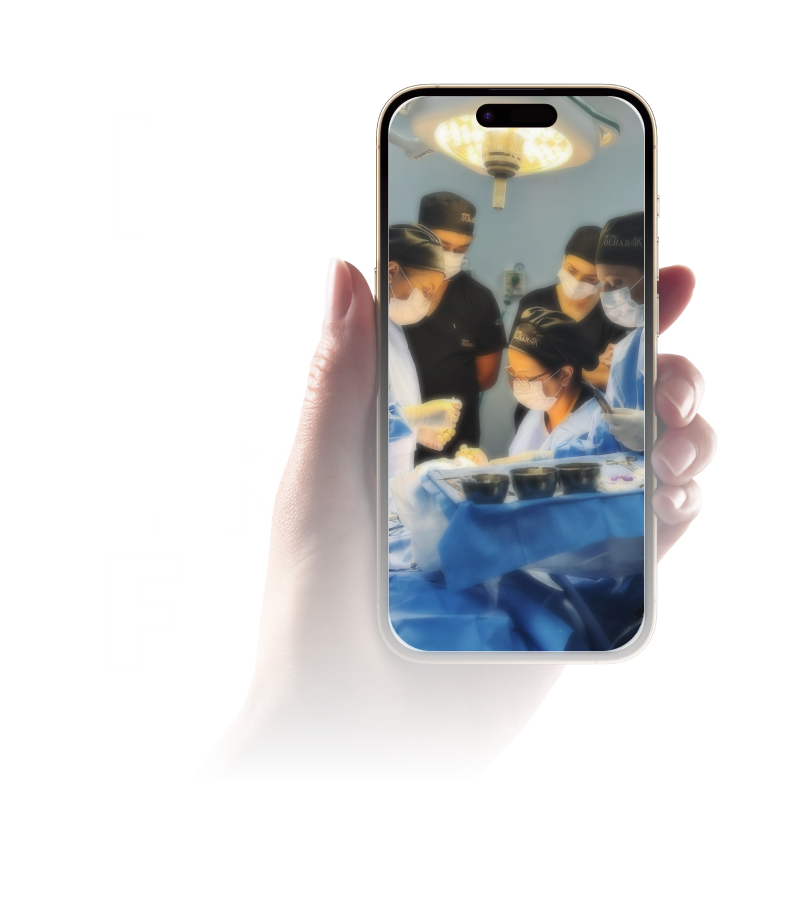 Método Olhar 4K é Bom mesmo