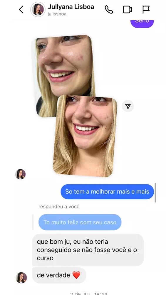 Curso Viver de Lentes em Resina é bom? depoimentos de alunos