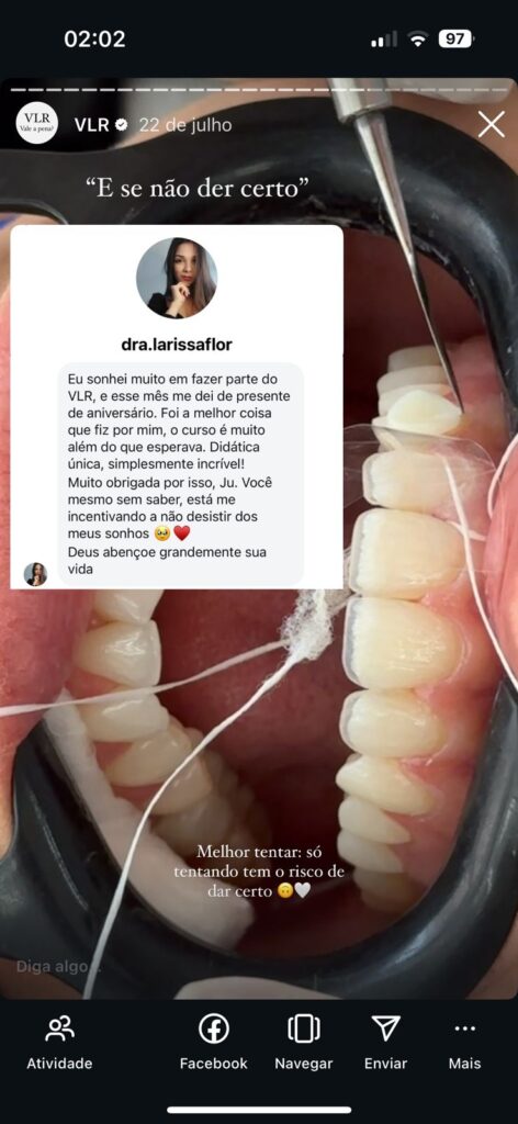 Curso Viver de Lentes em Resina é bom? depoimentos de alunos