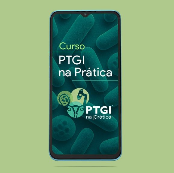 PTGI na prática vale a pena comprar?